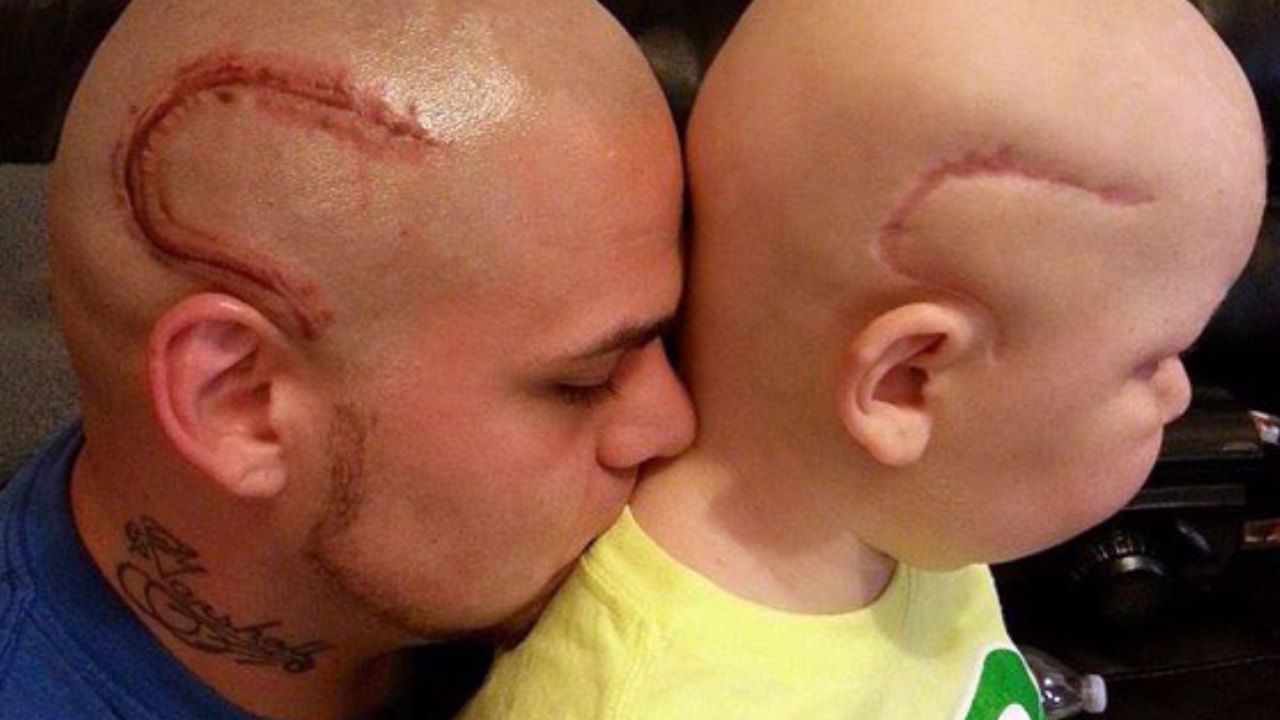 Dad Tattoos His Son’s Cancer Scar 